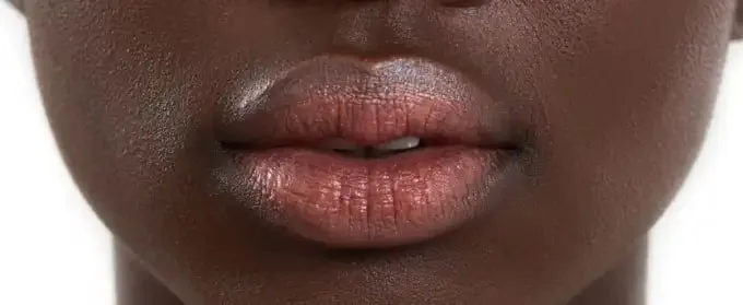 Dark Lip Neutralization Dubai — corrective lip blush